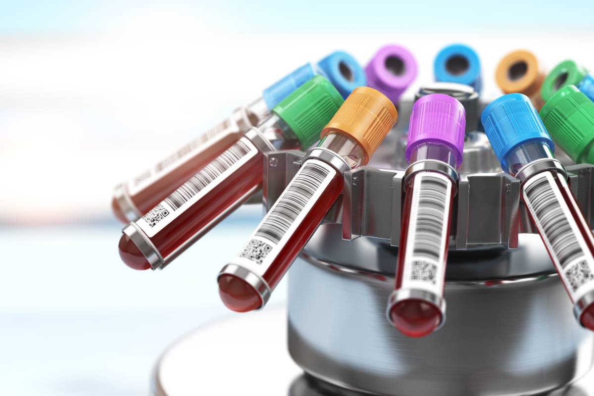 The Physiology Behind Therapeutic Plasma Exchange
