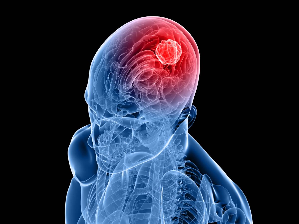 Algorithms for Tumor Detection 