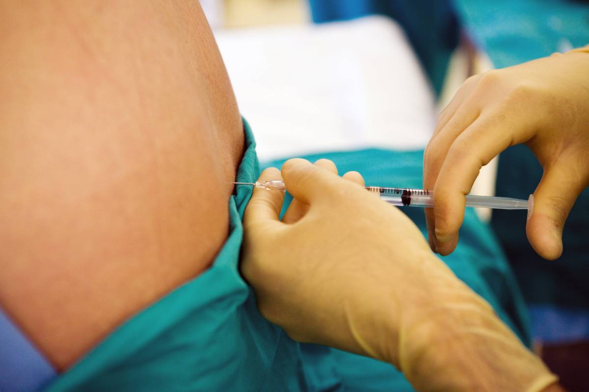 Anesthesia for Lumbar Spine Surgery