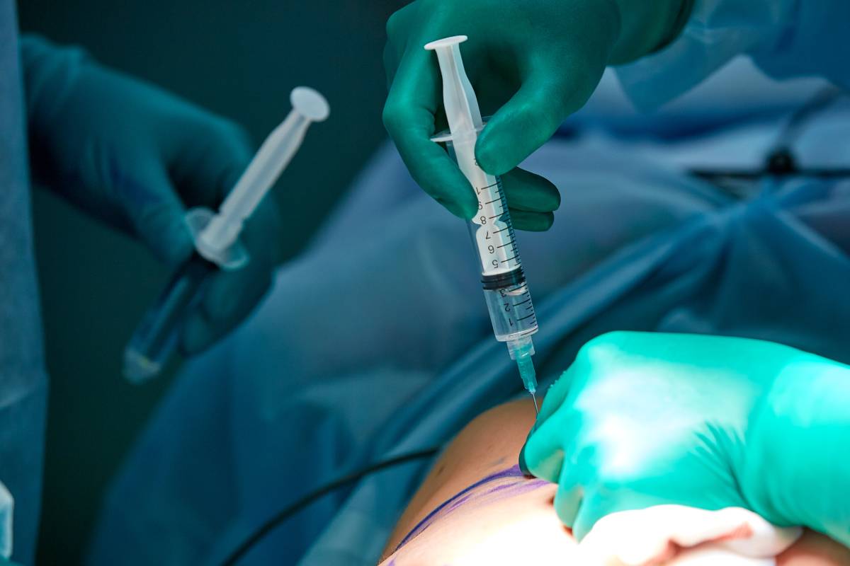 Local Anesthetic Systemic Toxicity