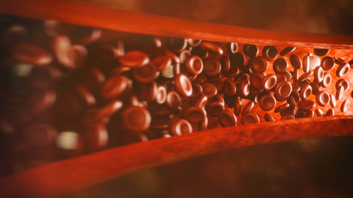 Blood Clot Risk After Surgery