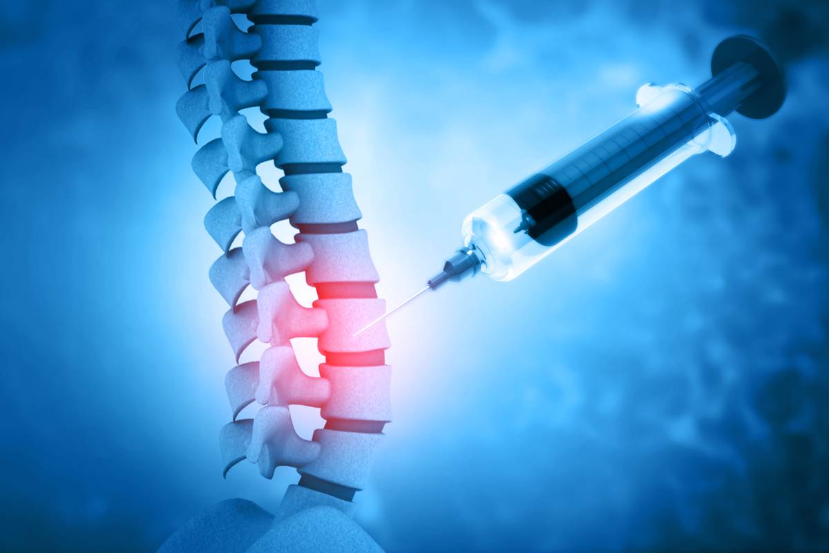 Spinal vs. Epidural Anesthesia