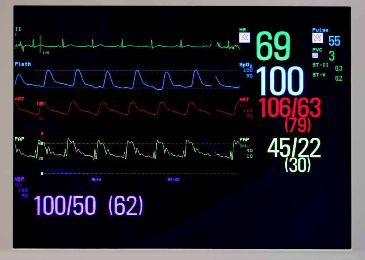 Image of vital sign monitor